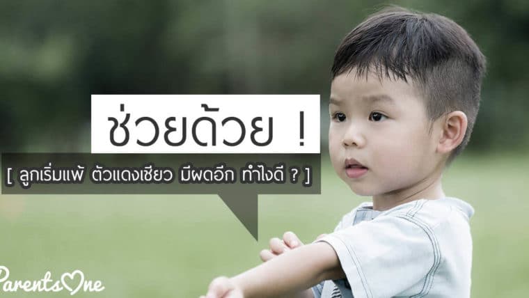 ช่วยด้วย ! ลูกเริ่มแพ้ ตัวแดงเชียว มีผดอีก ทำไงดี ?