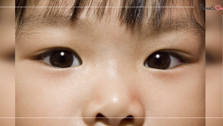 NEWS: ระวังเด็กเล็กเป็นโรคตาแดง โรคระบาดทางตาที่มาพร้อมหน้าฝน