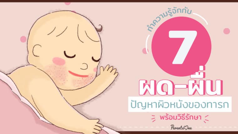 ทำความรู้จักกับ 7 ผด-ผื่น ปัญหาผิวหนังของทารก พร้อมวิธีรักษา