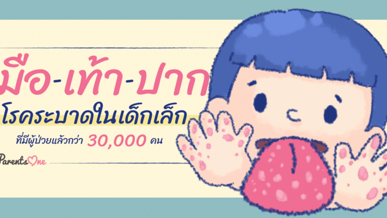 มือ-เท้า-ปาก โรคระบาดในเด็กเล็กที่มีผู้ป่วยแล้วกว่า 30,000 คน