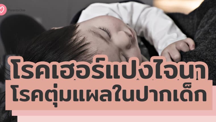 โรคเฮอร์แปงไจนา โรคตุ่มแผลในปากเด็ก