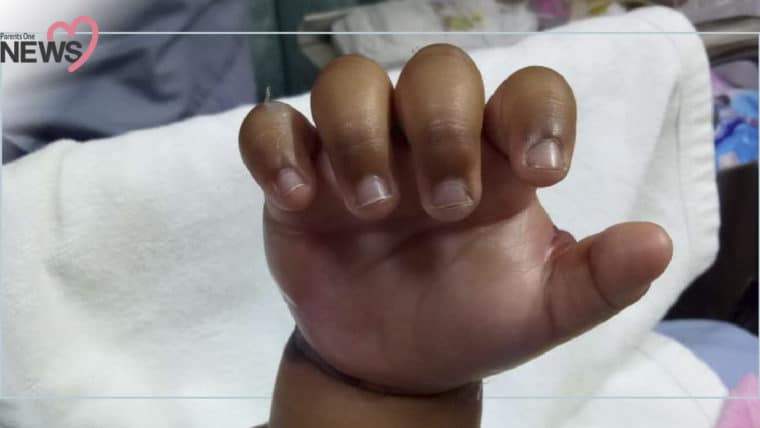 NEWS: โรงพยาบาลดังทำเด็กมือบวมหนัก เหตุแทงสายน้ำเกลือพลาด