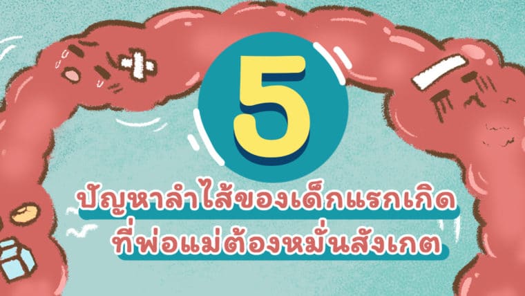 5 ปัญหาลำไส้ของเด็กแรกเกิด ที่พ่อแม่ต้องหมั่นสังเกต