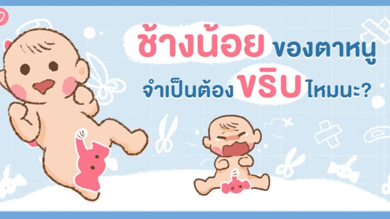 ช้างน้อยของตาหนูจำเป็นต้องขริบไหมนะ?