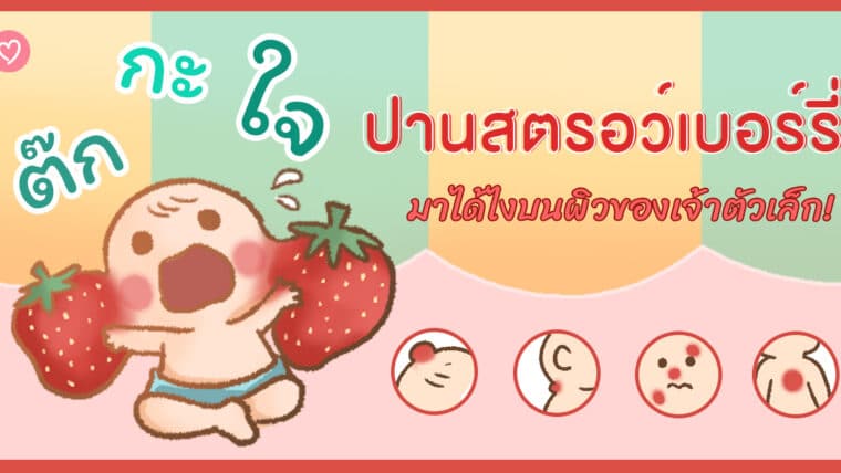 ต๊กกะใจ! ปานสตรอว์เบอร์รี่ มาได้ไงบนผิวของเจ้าตัวเล็ก!