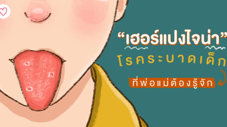 “เฮอร์แปงไจน่า” โรคระบาดเด็กที่พ่อแม่ต้องรู้จัก