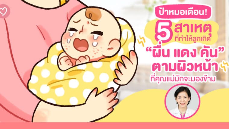 ป้าหมอเตือน! 5 สาเหตุที่ทำให้ลูกเกิด “ผื่น แดง คัน” ตามผิวหน้า ที่คุณแม่มักจะมองข้าม