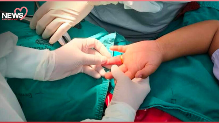 NEWS : อุทาหรณ์ต้อนรับขวัญหลาน แหวนติดนิ้วเด็ก 3 ขวบ ถอดไม่ออก รัดนิ้วบวมเป่งต้องส่งเข้าห้องผ่าตัด